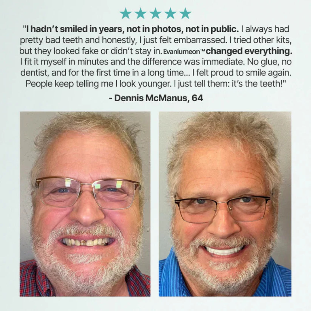 🌎Ends Today: 70% OFF! ⏰Evanlumeon™ Medical Full Denture with Strong Suctiond🦷Obtain American Dental Association (ADA) Certification