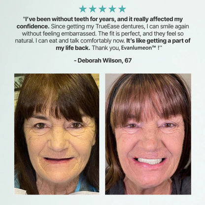 🌎Ends Today: 70% OFF! ⏰Evanlumeon™ Medical Full Denture with Strong Suctiond🦷Obtain American Dental Association (ADA) Certification