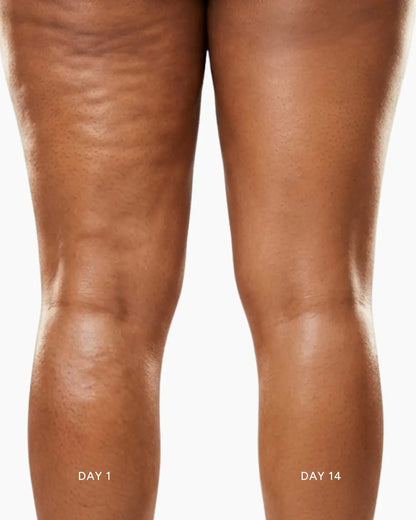 DermaQ Sculpt 3 Pro